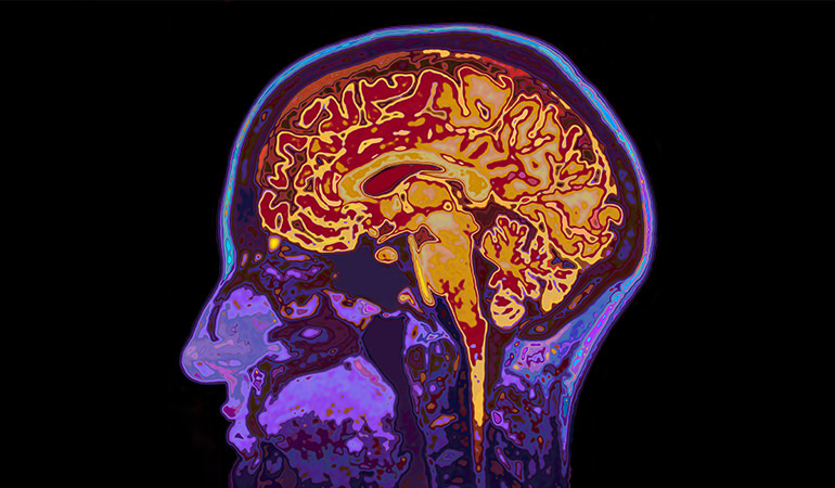 brain